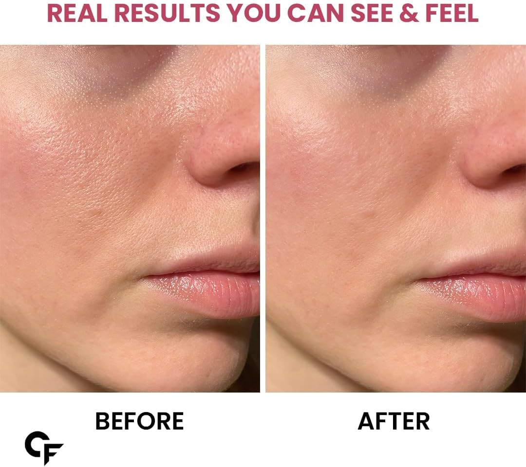 Collagen Biotin Gummies – Skin Glow, Hair Growth & Beauty Support