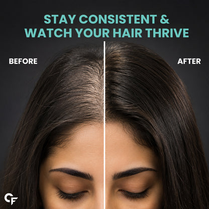 Carbamide Forte Biotin 2500mcg for Hair Growth | Biotin Supplement for hair, skin, and nails | Hair Vitamins for Men & Women | 120 Tablets