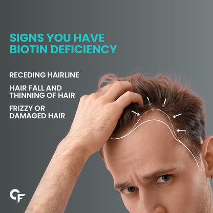 Biotin 2500mcg for Hair Growth - Biotin Supplement for hair, skin, and nails - 120 Tablets